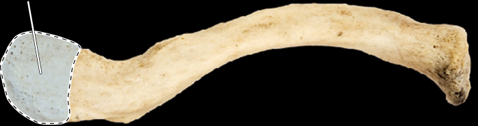 <p>clavicle</p>