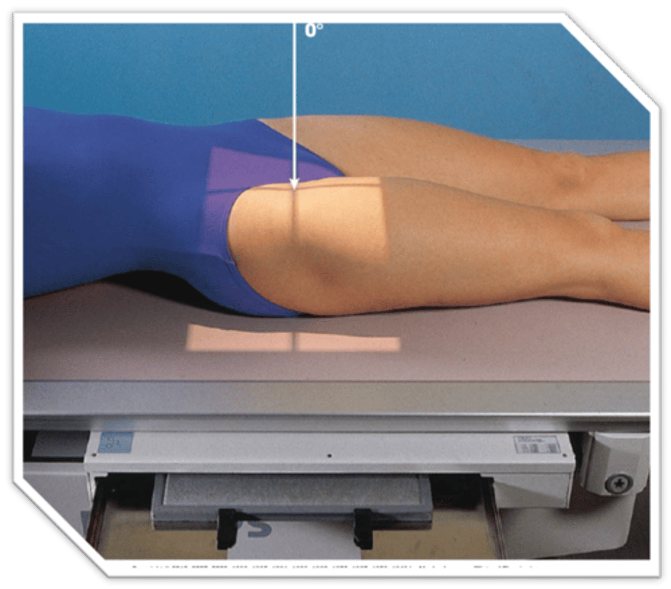 <p>CR perpendicular to the femoral neck.</p>
