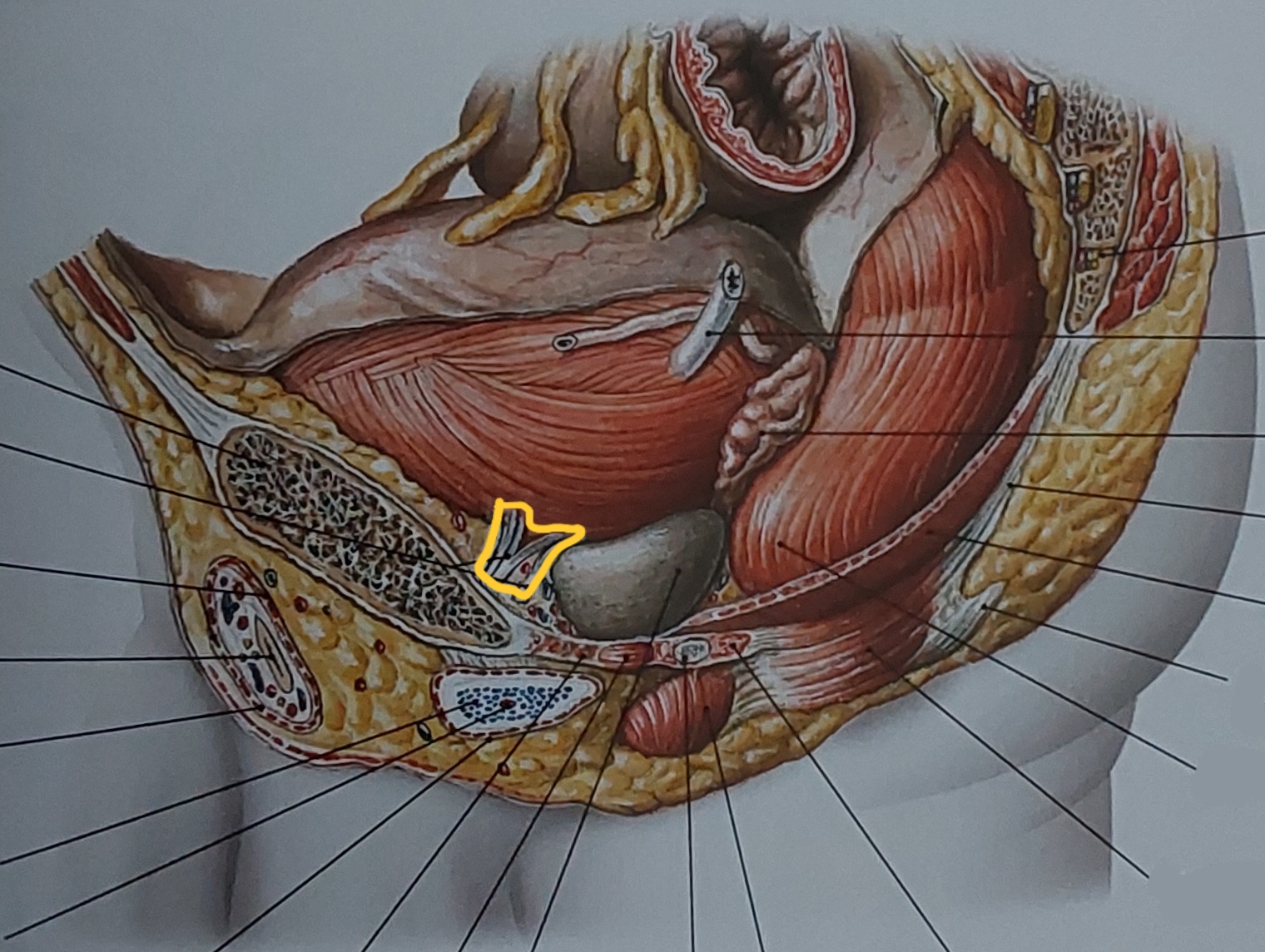 term image