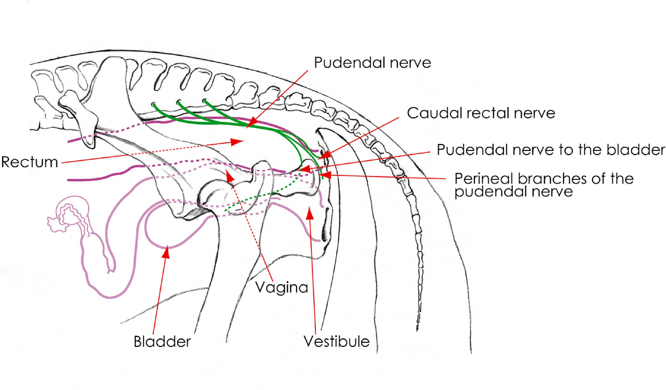 <ul><li><p>Deep lacerations extending into the corporeal body → haemospermia or incompetence.</p></li><li><p>Deep laceration extending into urethra → severe necrosis of tissue from escape of urine.</p></li><li><p>Damaged pudendal nerves → penis paralysis → protrusion of the penis and prepuce → cause further damage to exposed penile and preputial epithelium</p></li></ul><p></p>
