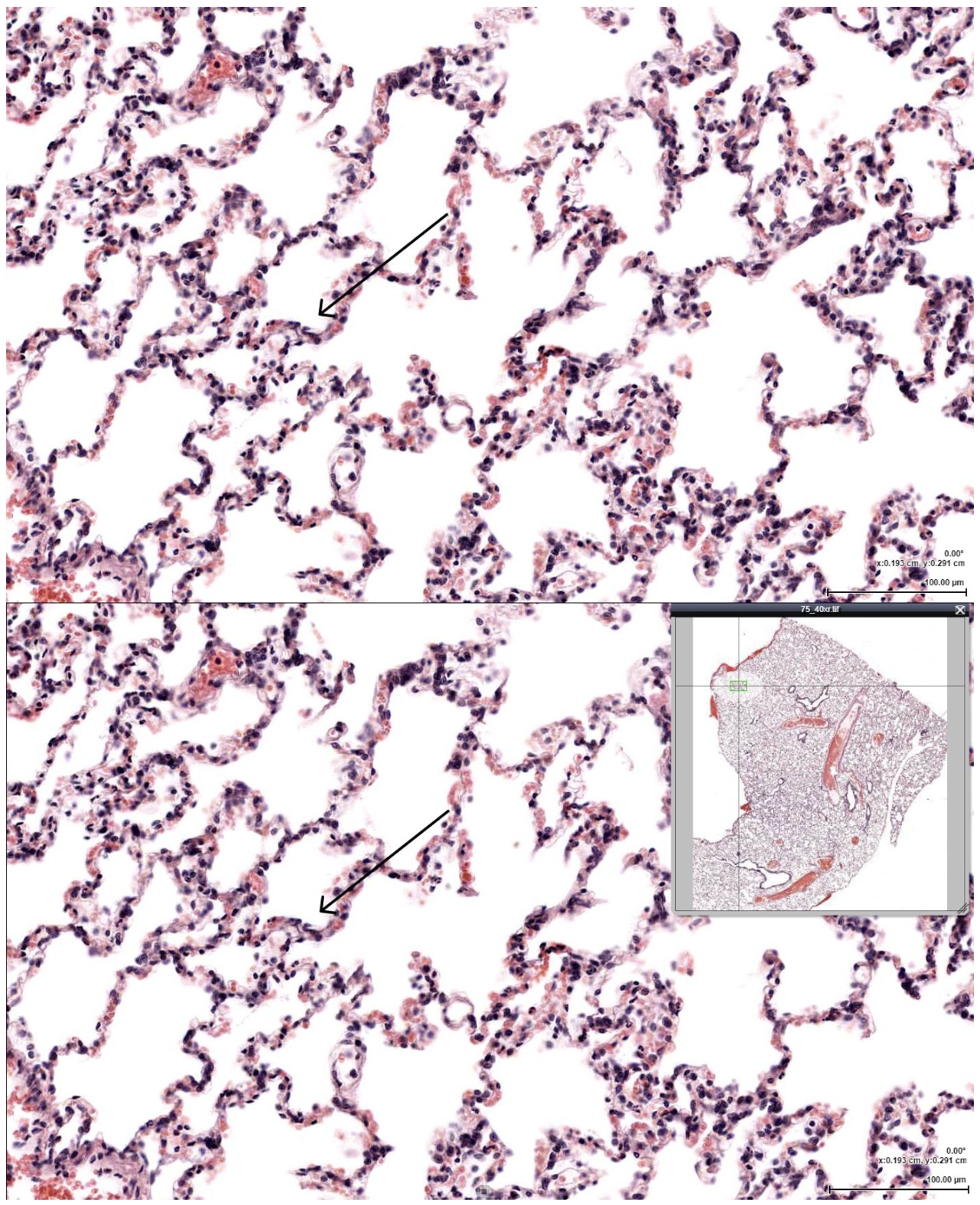 <p><span><span>Which of the following cells would be LEAST likely to be found lining the indicated structure?</span></span></p>