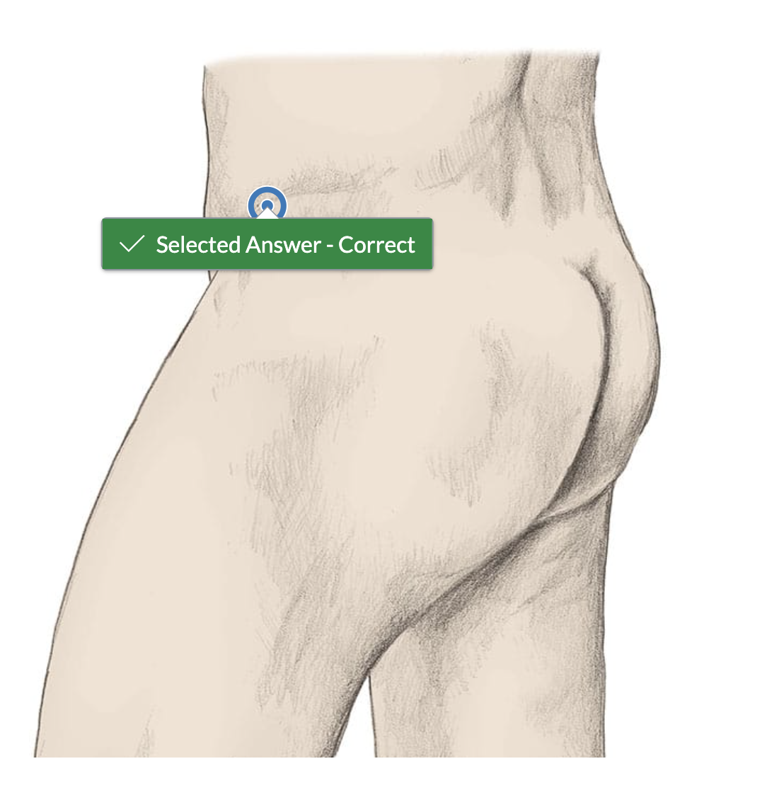 <p>lateral waist</p>