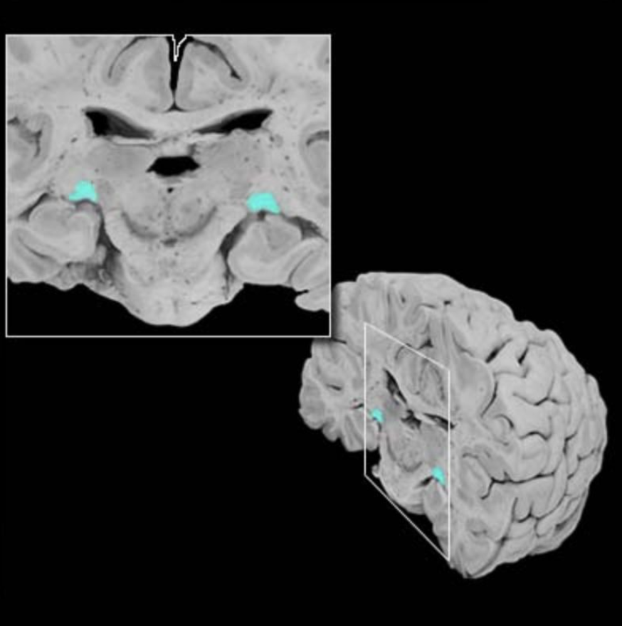 <p>Lateral geniculate nucleus</p>