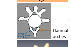 <p>Coccygral artery. </p><p>first few coccygeal vertebrae</p>