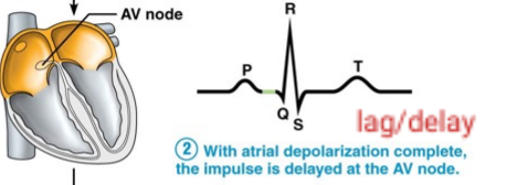 With atrial depolarization complete, the impulse is delayed at the AV node.
