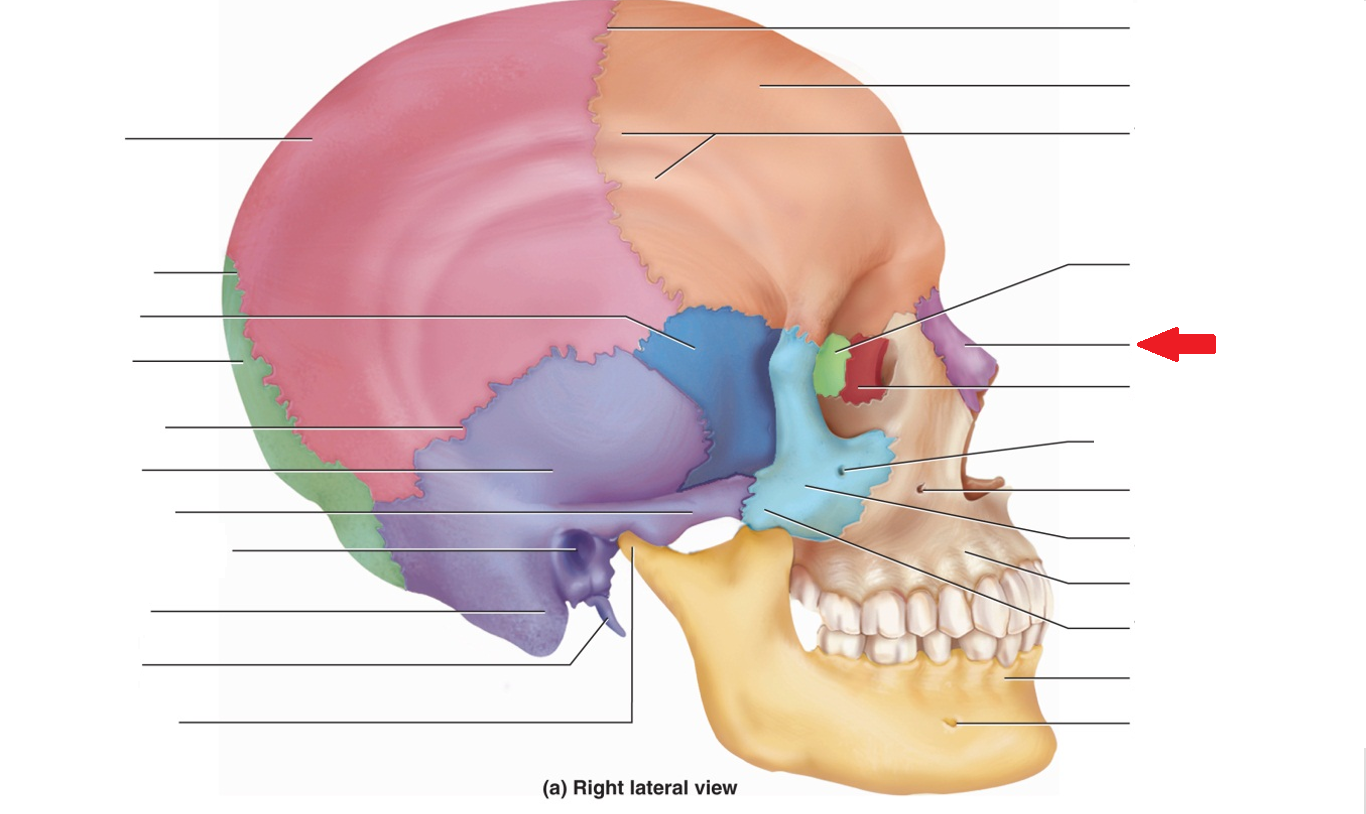 term image