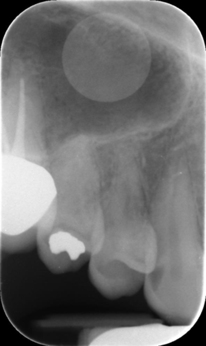 <p>What is this error?</p>