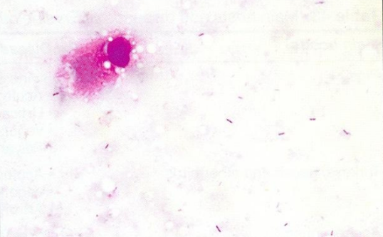 <ol><li><p>SN </p></li><li><p>Form </p></li><li><p>G+ / -?</p></li></ol><p>[in vegetative lesions on the heart valves of a pig]</p>