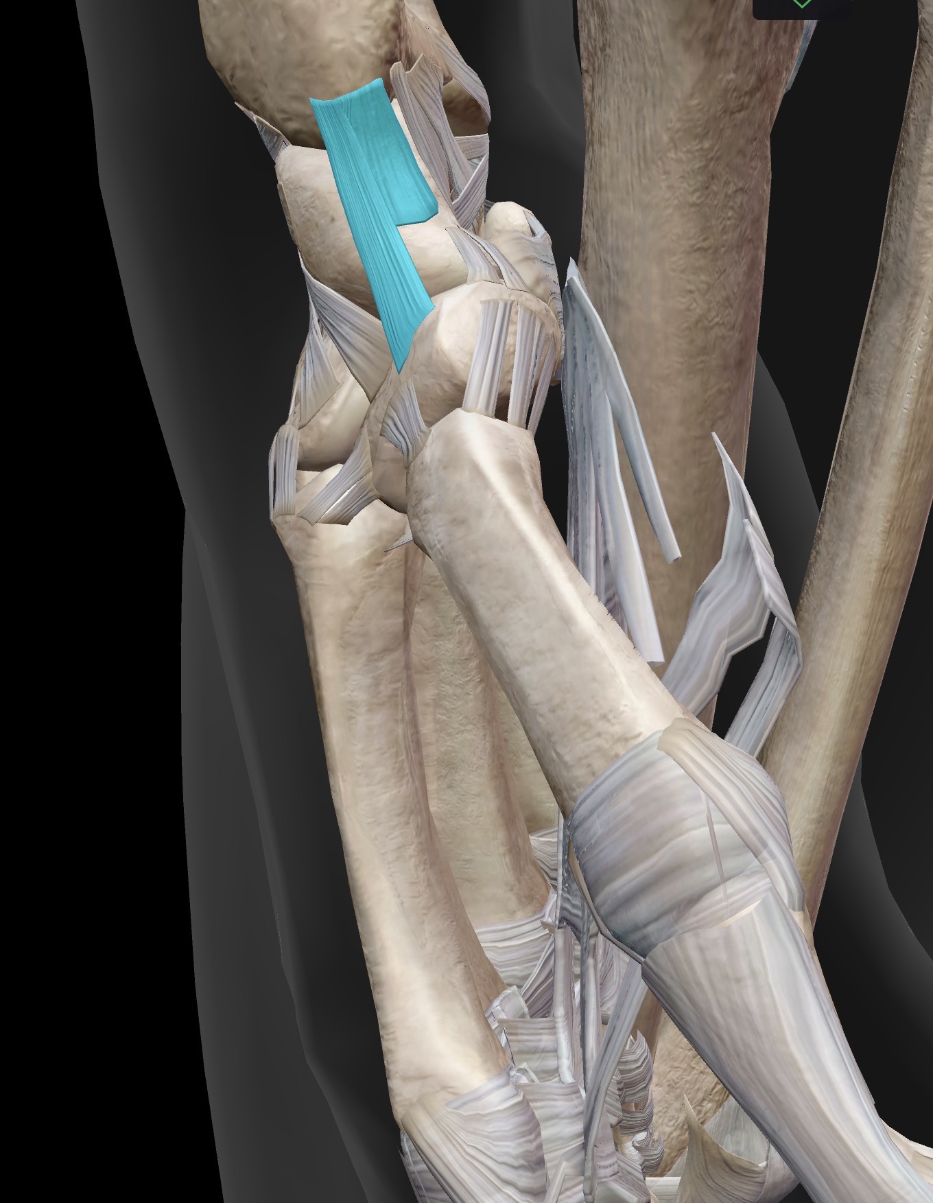 <p>What ligament is this? What does it do?</p>