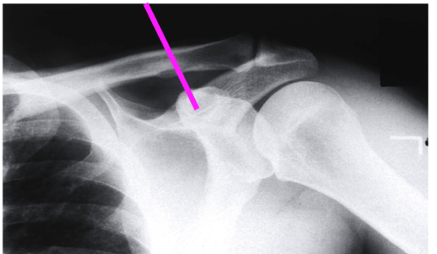 <p>what does the pink line point to?</p>