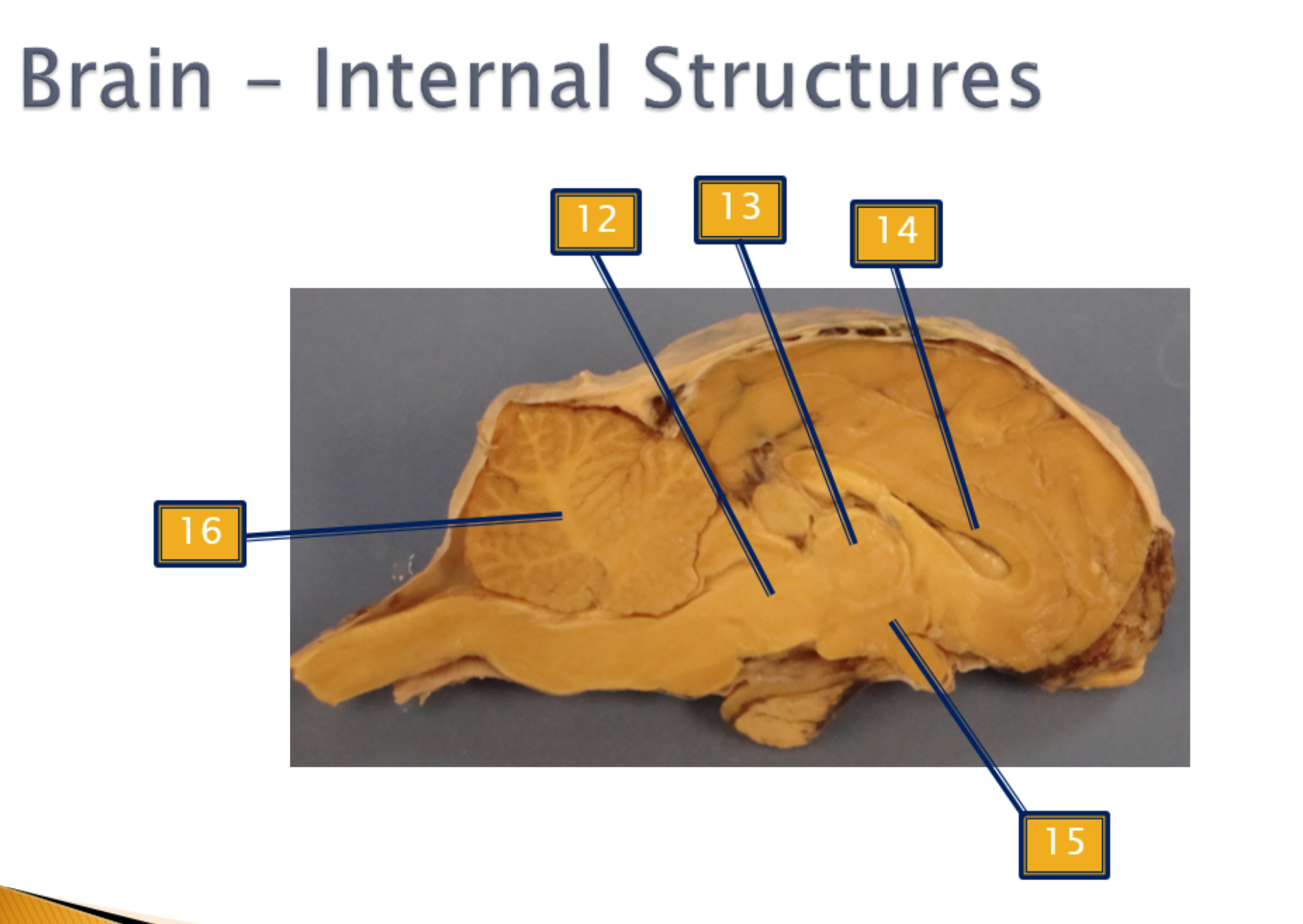 <p>Internal structure</p>