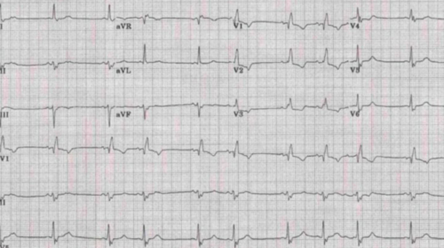 <p>What are the findings</p>