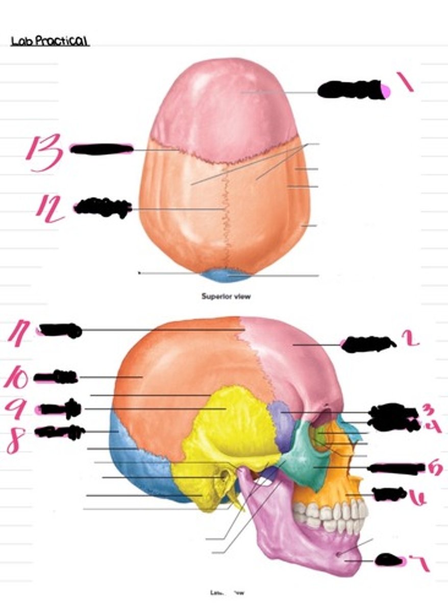 <p>What structure is #3?</p>