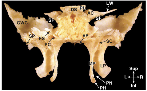 <p>What area of the sphenoid does GWC stand for?</p>