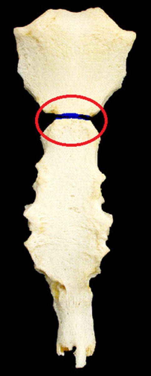 <p>Ridge between manubrium and body at second rib</p>