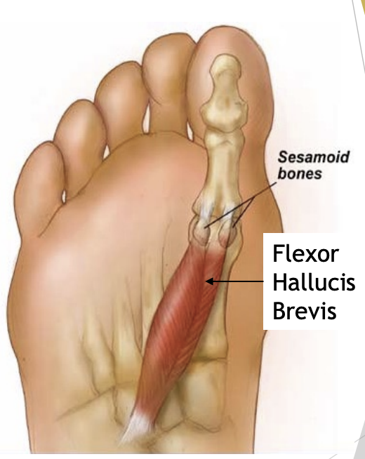 <p>Sesamoid bones</p>