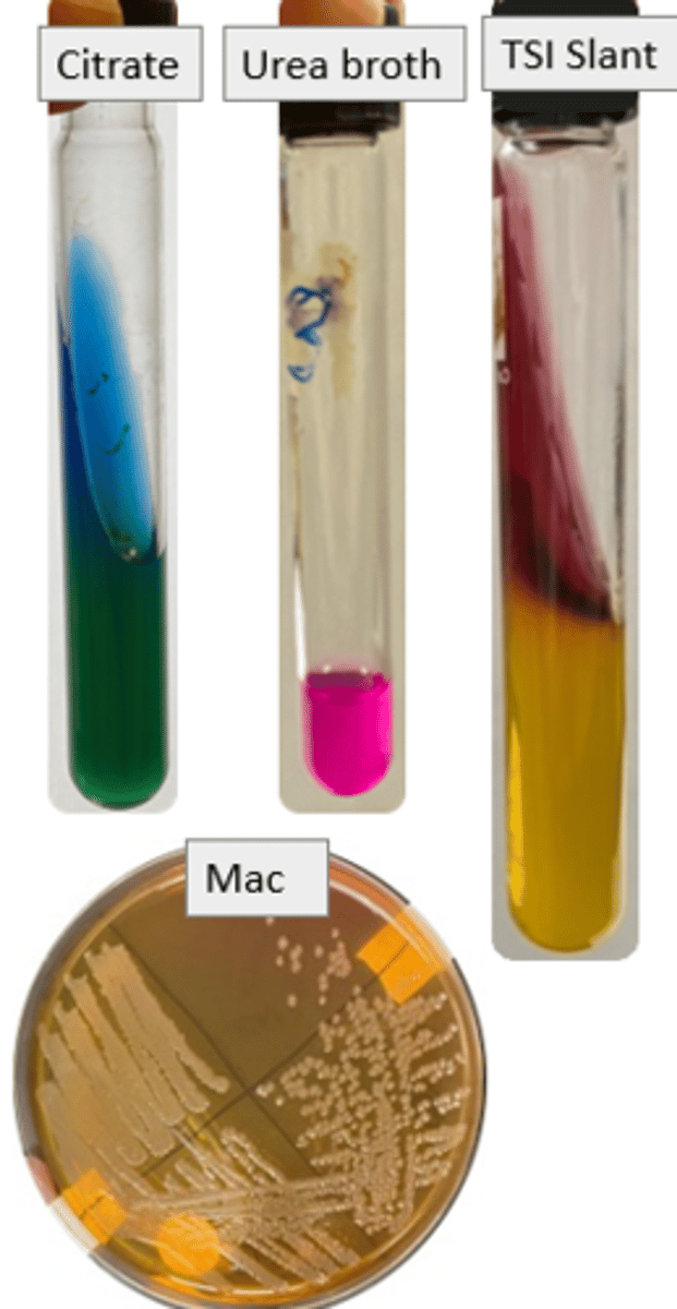 <p>Mac fermentation: neg</p><p>Urease: + (pink)</p><p>citrate: + (blue)</p><p>TSI Slant: alkaline</p><p>TSI butt: acidic</p><p>Gas: neg</p><p>H2S: +</p>
