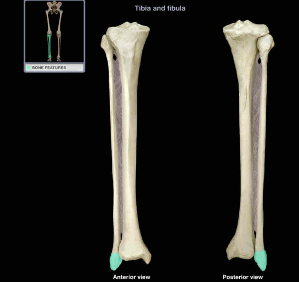 <p>Lateral malleolus</p>
