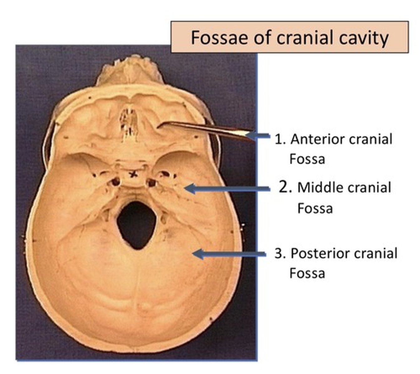 <p>1. Anterior cranial fossa</p><p>2. Medial cranial fossa</p><p>3. Posterior cranial fossa</p>