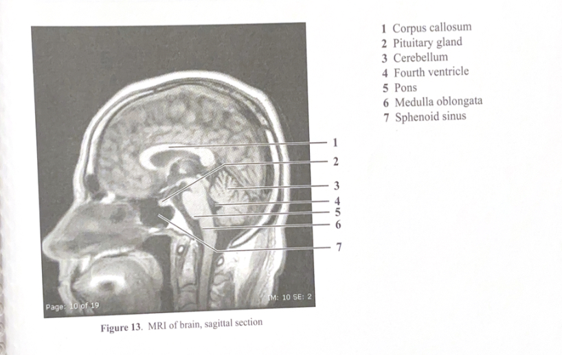 <ol><li><p>Corpus callosum&nbsp;</p></li><li><p>Pituitary gland&nbsp;</p></li><li><p>Cerebellum&nbsp;</p></li><li><p>Fourth ventricle&nbsp;</p></li><li><p>Pons&nbsp;</p></li><li><p>Medulla oblongata&nbsp;</p></li><li><p>Sphenoid sinus&nbsp;</p></li></ol><p></p>