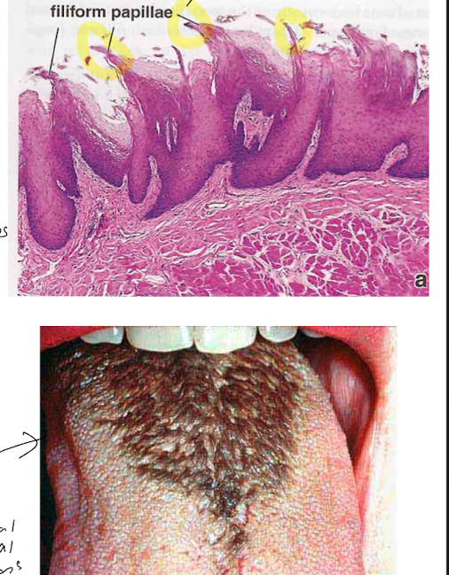 <ul><li><p>most numerous, conical structures on anterior 2/3 of tongue </p></li><li><p>NO taste buds </p></li><li><p>keritinized simple squamous </p></li><li><p>mechanical function (ex: licking) </p></li><li><p>white in colour</p></li></ul>