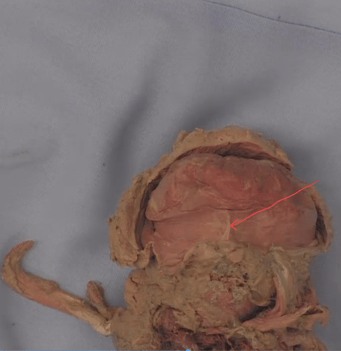 <p>identify this structure</p>