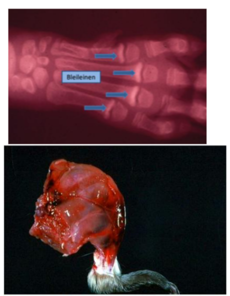 <p>Autres maladies nutritionnelles et toxicités liés aux os</p>