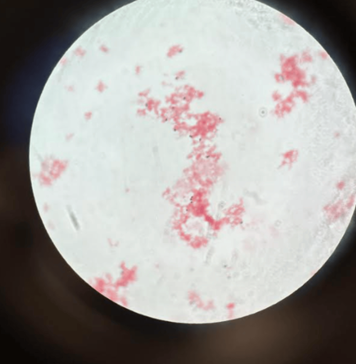 <p>For the yogurt test, what is stained red?</p>