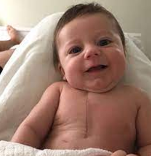 <p><strong>Congenital:</strong></p><ul><li><p class="">Tetralogy of Fallot</p></li><li><p class="">Tricuspid Atresia</p></li><li><p class="">Atrial Septal Defect (ASD)</p></li><li><p class="">Ventricular Septal Defect (VSD)</p></li><li><p class="">Atrioventricular (AV) Canal Defect</p></li><li><p class="">Patent Ductus Arteriosus (PDA)</p></li></ul><p class=""><strong>Acquired:</strong></p><ul><li><p class="">Heart Failure</p></li><li><p class="">Endocarditis</p></li><li><p class="">Rheumatic Fever</p></li><li><p class="">Cardiomyopathy</p></li><li><p class="">Hypertension (HTN)</p></li><li><p class="">Kawasaki Disease</p></li><li><p class="">Hyperlipidemia</p></li><li><p class="">Transplant</p></li></ul><p></p>