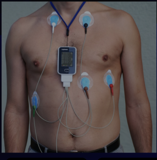 <p>is a portable recorder used to record the ECG continuously throughout the patient’s usual activities</p>