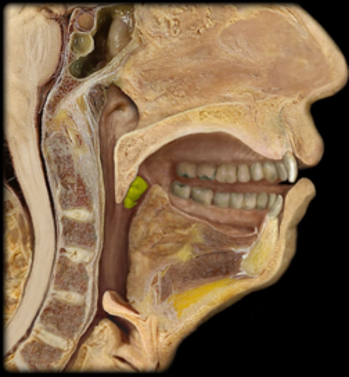 <p>Identify this specific structure.</p>