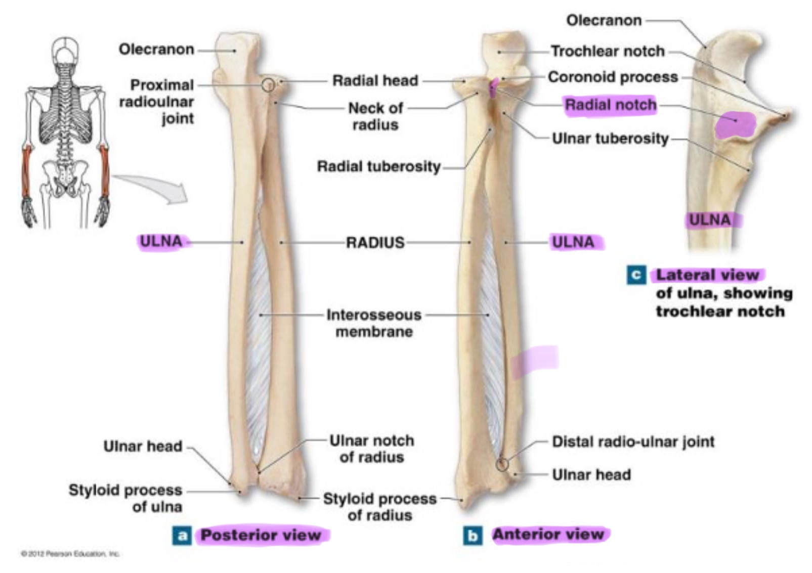 <p>small, smooth depression on the lateral side of proximal ulna; articulates w/ head of radius to form proximal radioulnar joint (rotation of forearm)</p>