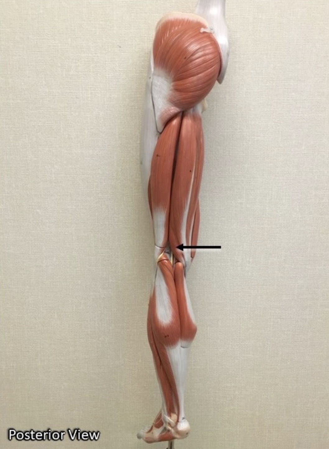 <p><span>Name the muscle labeled with the arrow below AND name the origin .</span></p>