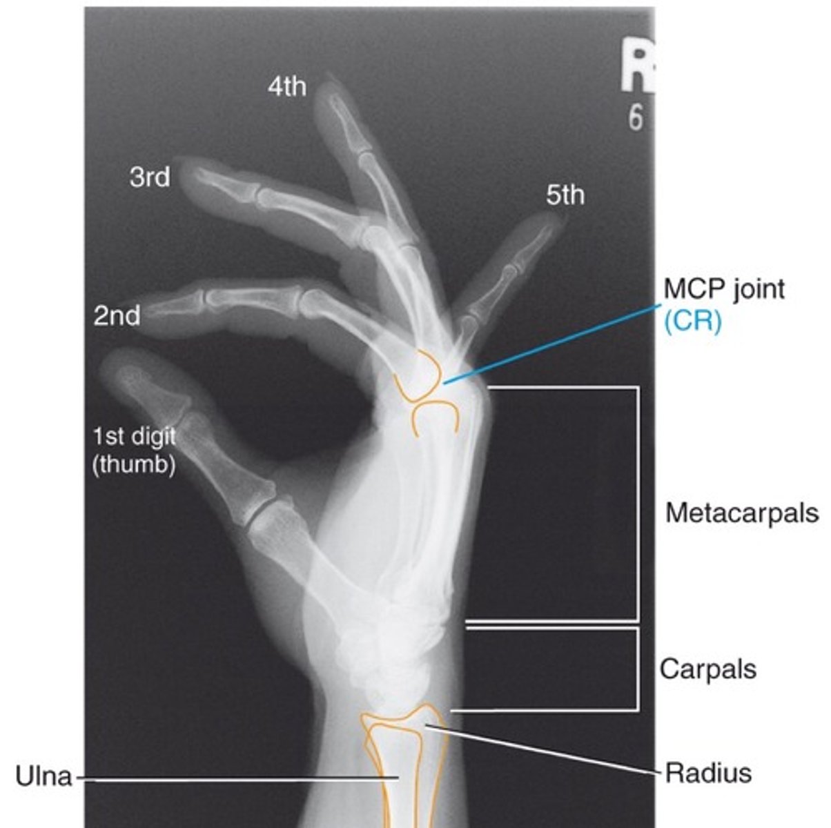 <p>-extended digits</p><p>-Hand in a true lateral position</p><p>-superimposed phalanges</p><p>-superimposed metacarpals</p><p>-superimposed distal radius and ulna</p><p>-thumb free of motion and superimposition</p>