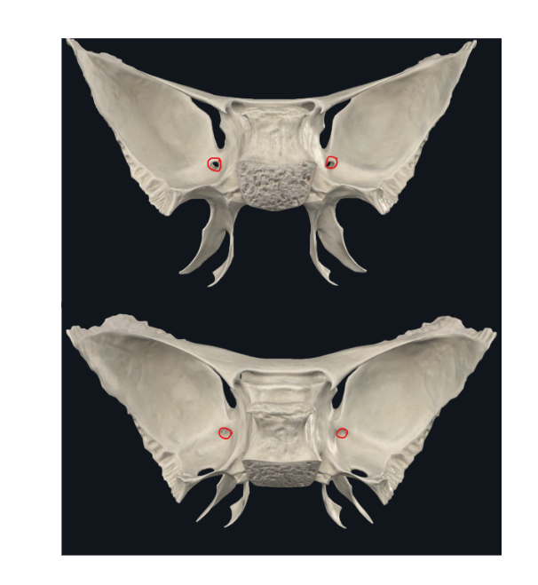 <p>Foramen rotundum</p>