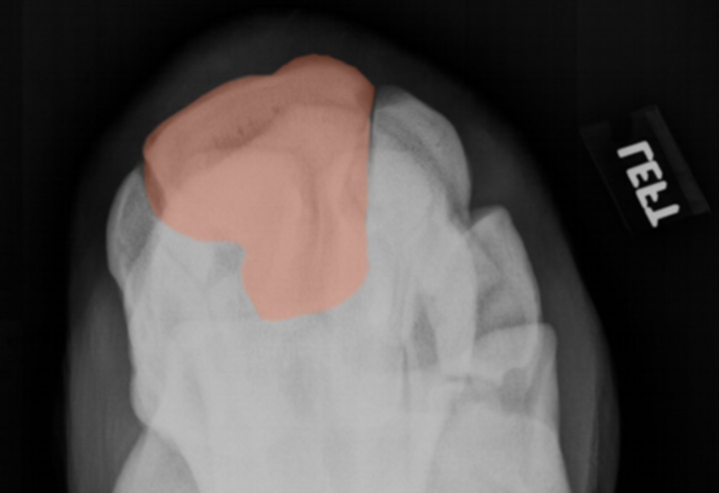 <p>What bone is highlighted?</p>