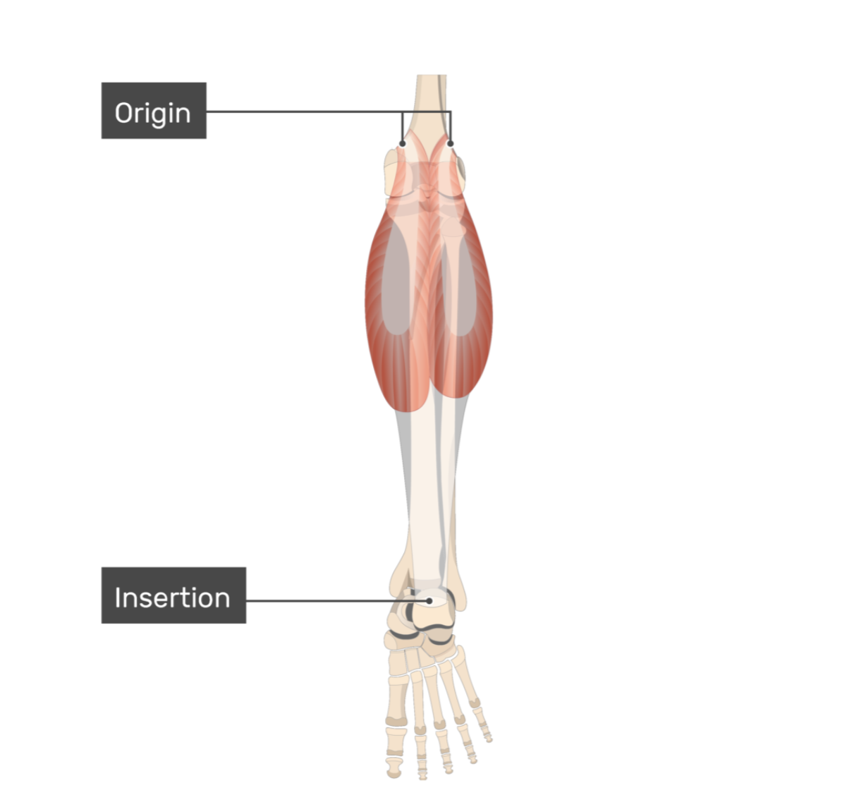 <p>gastrocnemius, medial head</p>