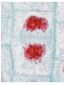 What stage of mitosis 
