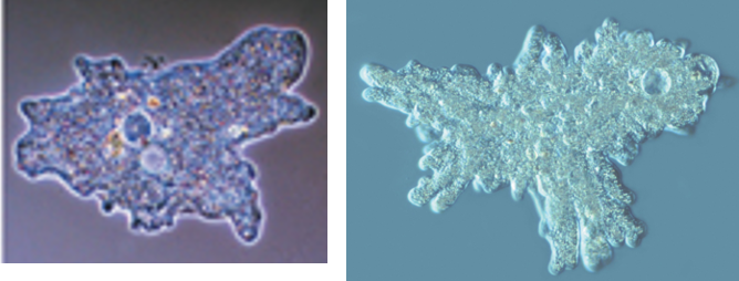 <p>This member of the Amoebozoa supergroup has:</p><ul><li><p>Emorphic shape</p></li><li><p>It’s very different</p></li><li><p>Essentially a blob</p></li></ul>