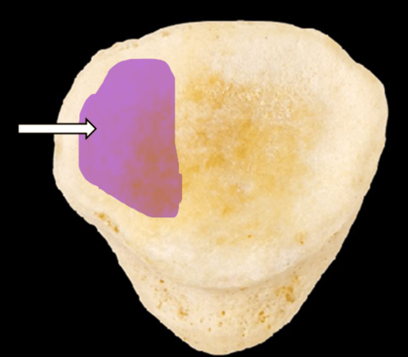 <p>name the part</p>