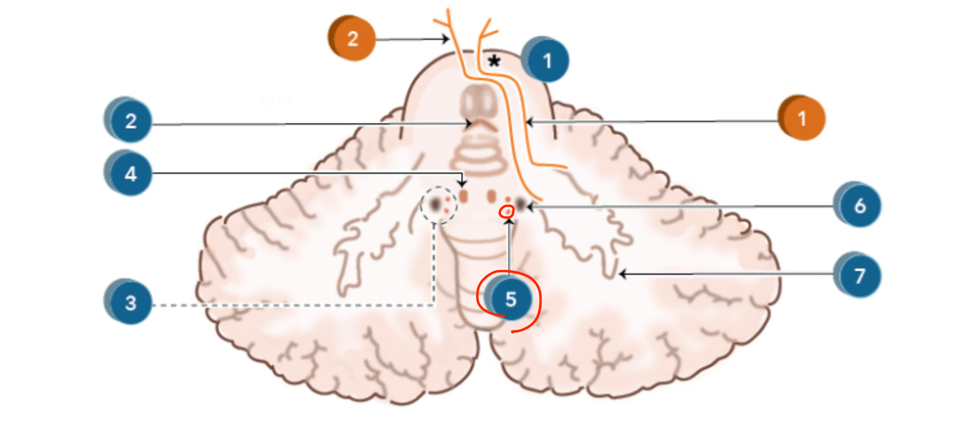 <p>Globose nucleus</p>