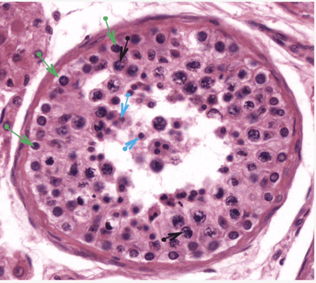 <p>Identify the cells (BLACK ARROW)</p>