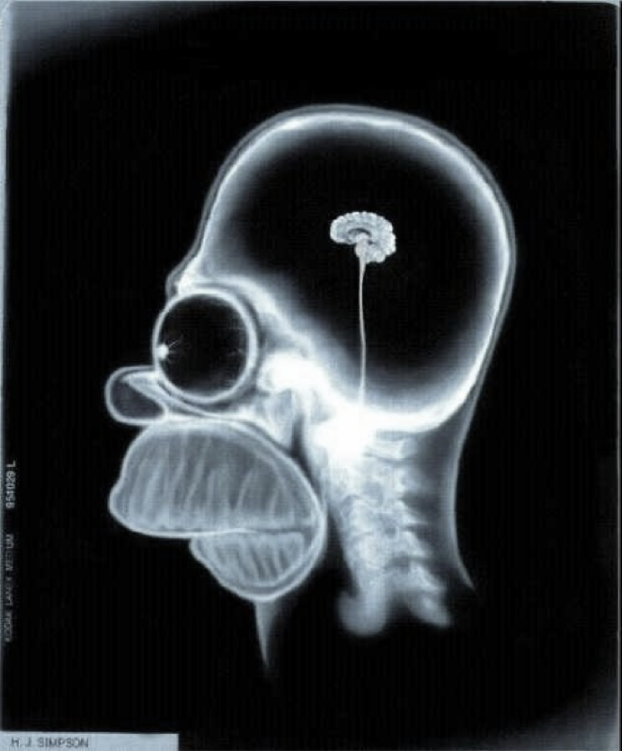 <p>the skull is ___ to the brain</p>