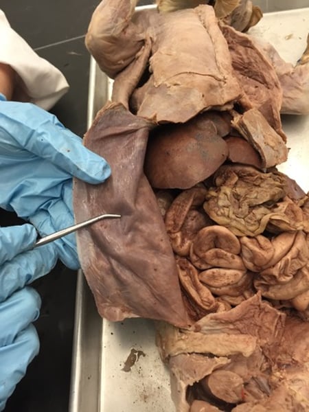 <p>the outer layer of the peritoneum that lines the interior of the abdominal wall</p>