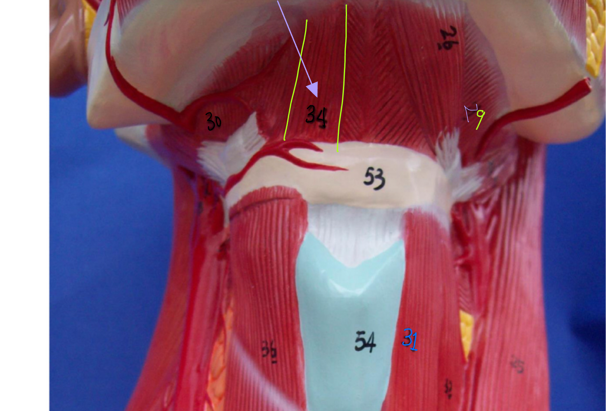 <p>What type of muscle is this ( altay model)</p>