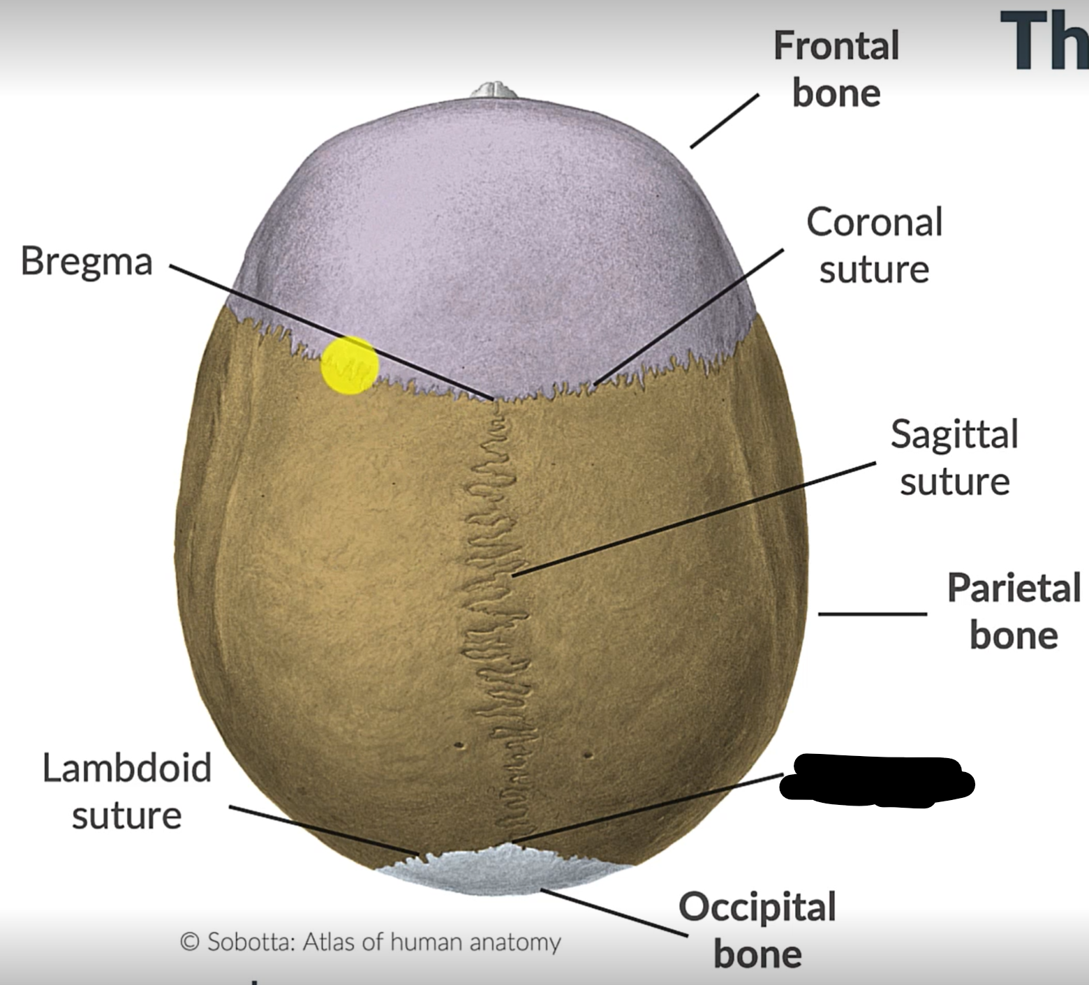 term image