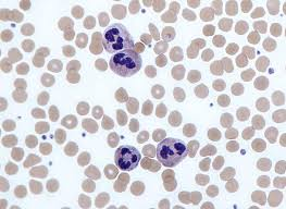 <p>neutrophils </p>
