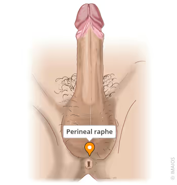 <ul><li><p>superficial median seam that overlies median septum</p><ul><li><p>extends anteriorly along ventral side of penis and posteriorly to anus</p></li></ul></li></ul><p></p>