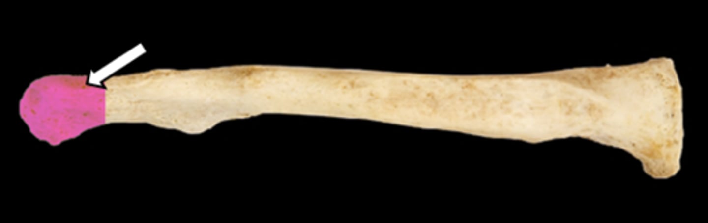 <p>name the part</p>