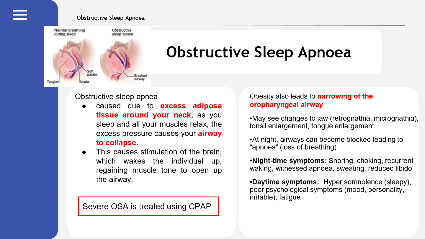 <p>Firstly snoring, briefly stop breathing then wake up quickly. N3 to N1 quickly. Very tired during the day.</p>